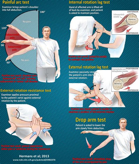 assessment test for gross rotator cuff tear|rotator cuff evaluation maneuvers.